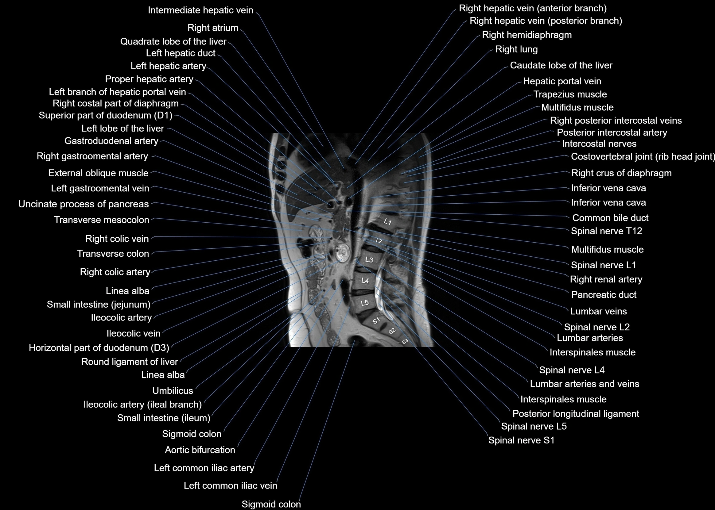 MRI abdomen sagittal cross sectional anatomy  radiology  image-img-00001-00034.webp